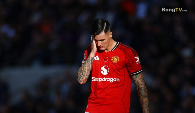 Sesko phải ngồi ngoài vì chấn thương.